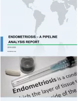 Endometriosis - A Pipeline Analysis report